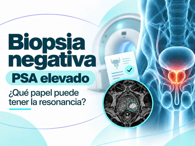 Biopsia de próstata negativa y PSA elevado