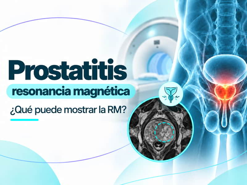 Prostatitis y resonancia magnética: qué puede mostrar la RM