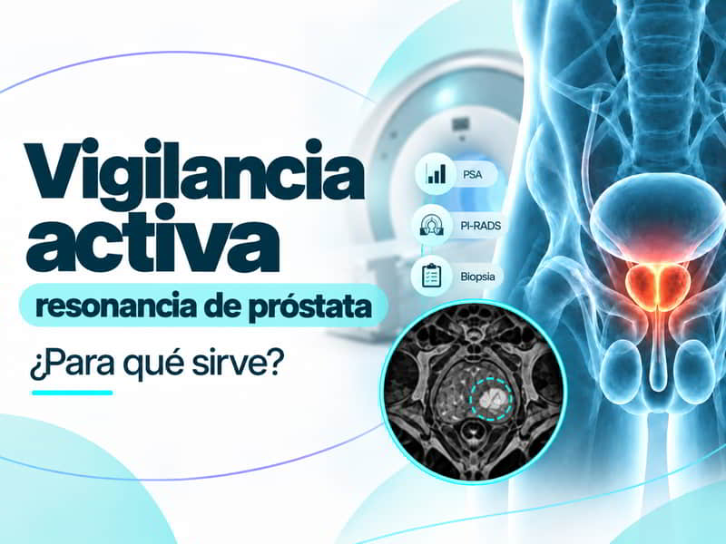 Resonancia de próstata en vigilancia activa