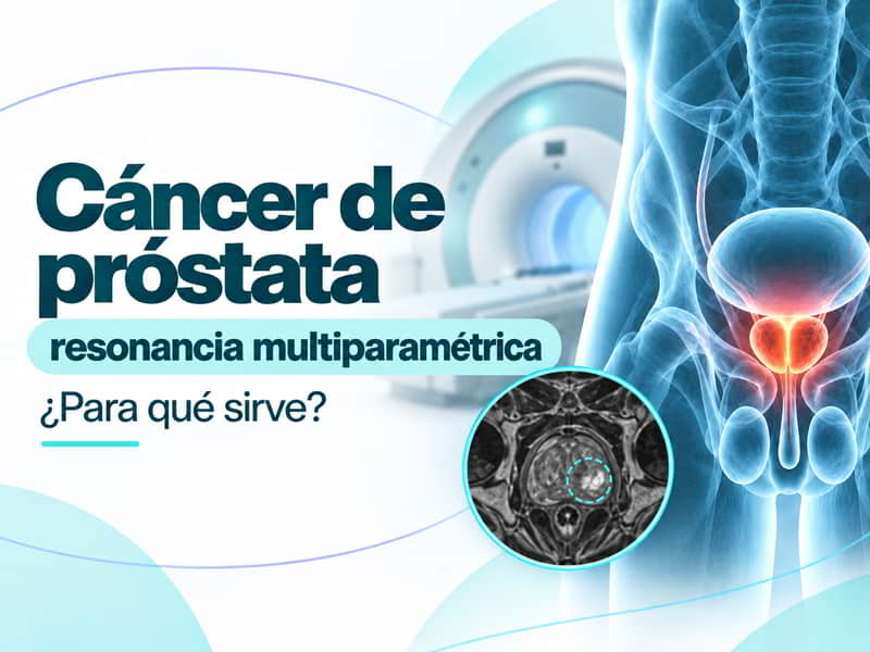 Resonancia multiparamétrica y cáncer de próstata