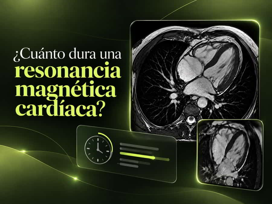 Cuánto dura una resonancia magnética cardíaca: duración del estudio y preparación