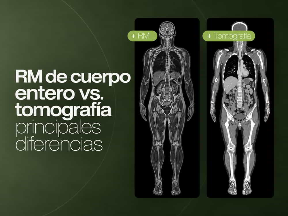 RM de cuerpo entero vs tomografía: principales diferencias