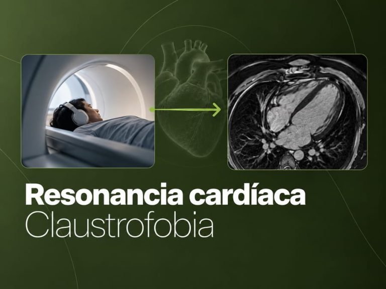 Paciente que consulta por claustrofobia y ansiedad antes de una resonancia magnética cardíaca