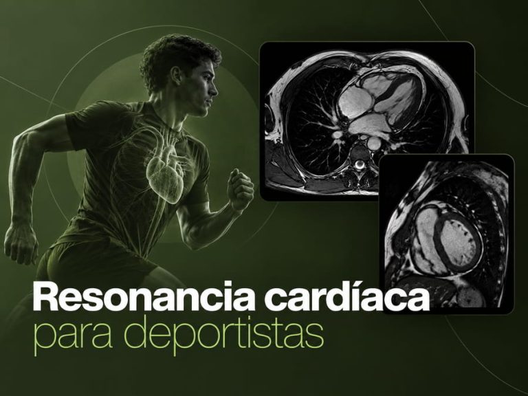 Resonancia magnética cardíaca para deportistas y evaluación del corazón de atleta
