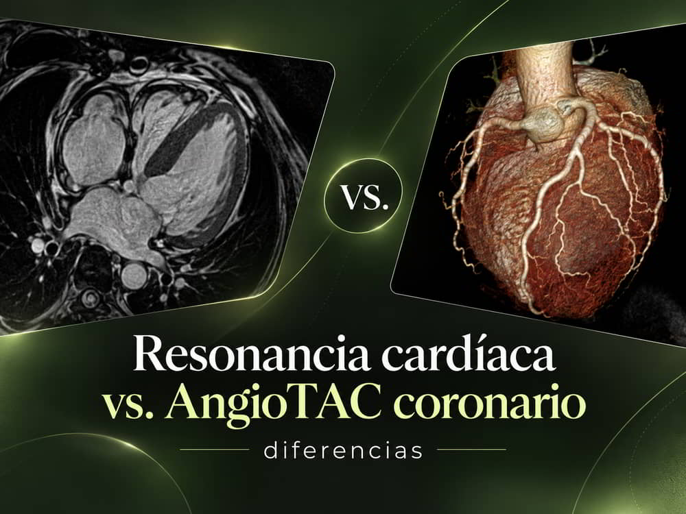 Comparación entre resonancia magnética cardíaca y AngioTAC coronario