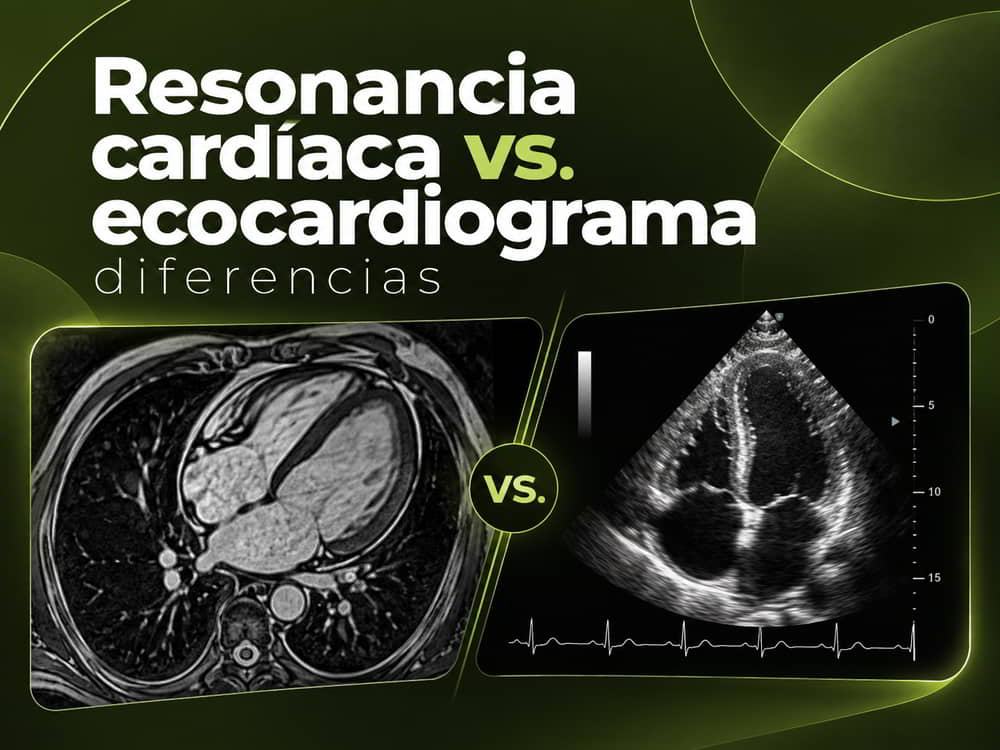 Comparación entre resonancia magnética cardíaca y ecocardiograma