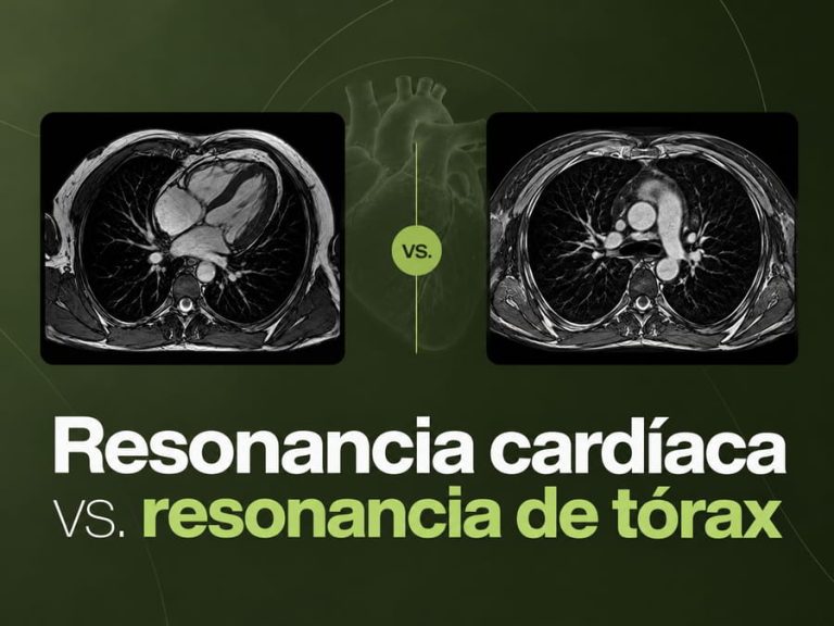 Comparación de resonancia magnética cardíaca y resonancia magnética de tórax
