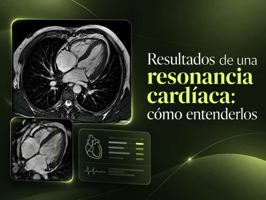 Resultados de resonancia cardíaca y explicación de un informe médico