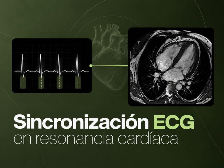 Sincronización ECG mediante electrodos durante una resonancia magnética cardíaca