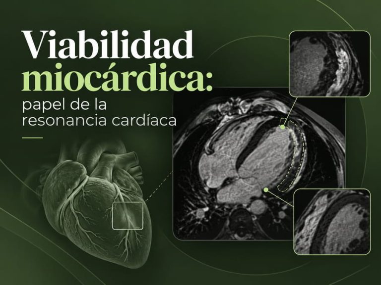 Viabilidad miocárdica evaluada mediante resonancia magnética cardíaca
