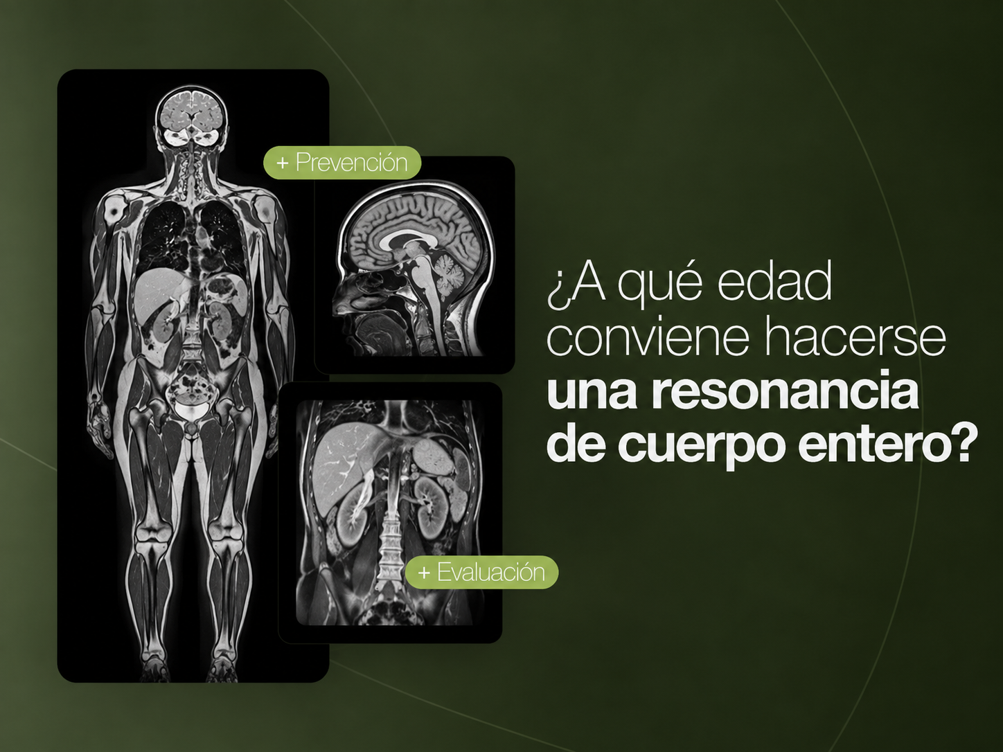 A qué edad conviene hacerse una resonancia de cuerpo entero