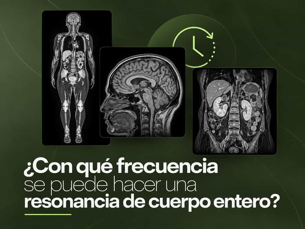 Con qué frecuencia se puede hacer una resonancia de cuerpo entero