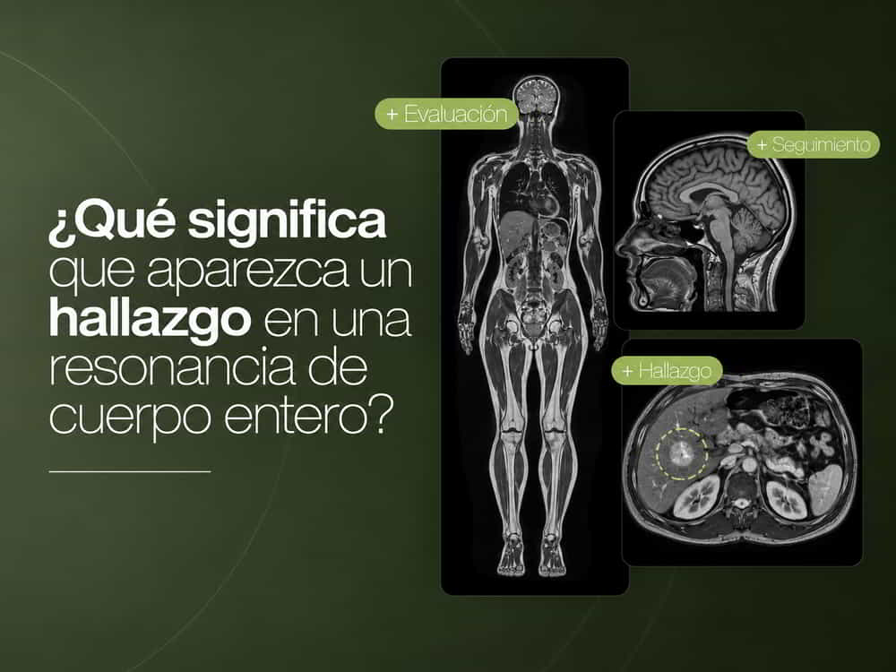 Qué significa un hallazgo en una resonancia de cuerpo entero