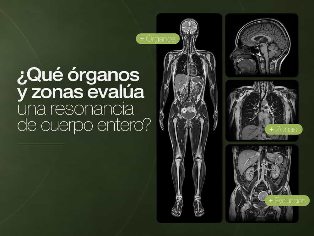 Qué órganos y zonas evalúa una resonancia de cuerpo entero