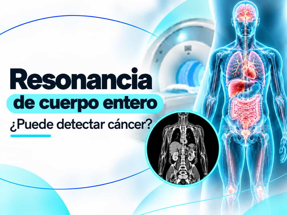 ¿Una resonancia de cuerpo entero puede detectar cáncer?